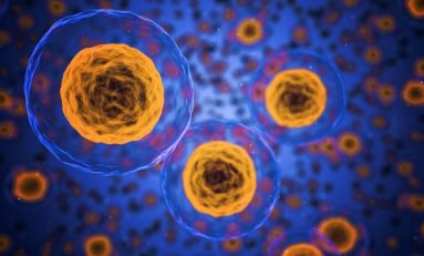Sclerosi multipla: novità da trapianto di cellule staminali